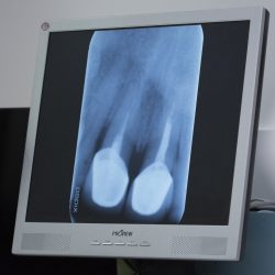FotosMéticaDental (6)